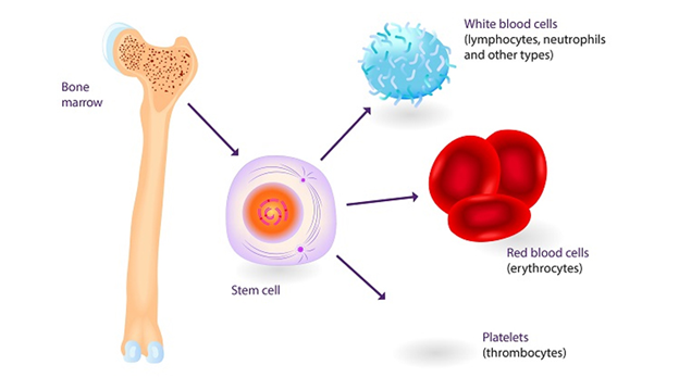 Cấy ghép tế bào gốc là phương pháp thay thế các tế bào gốc bị hư hỏng của bệnh nhân bằng các tế bào gốc khỏe mạnh